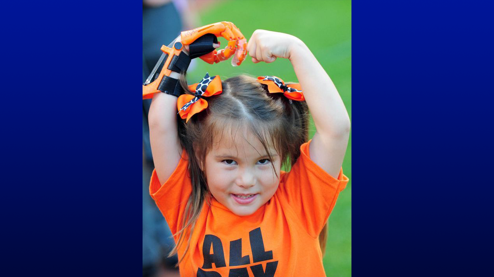 7-year-old-with-robotic-hand-to-throw-out-first-pitch-at-world-series