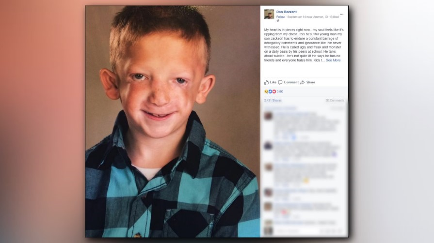 Dad S Post About Son S Bullying Goes Viral